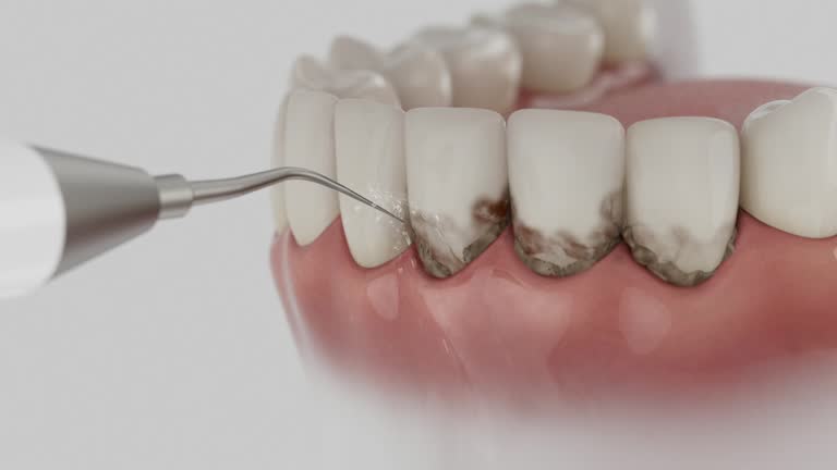 Reliable Dental Implants contractor in St. Cloud, FL by Smile Center Dentistry